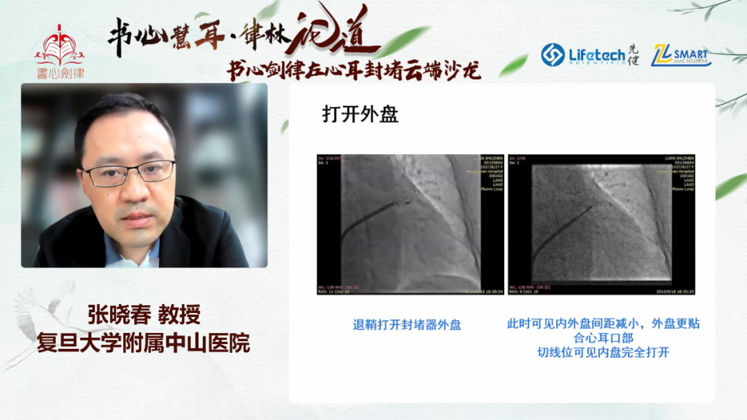 微信图片4.png 微信图片4.png